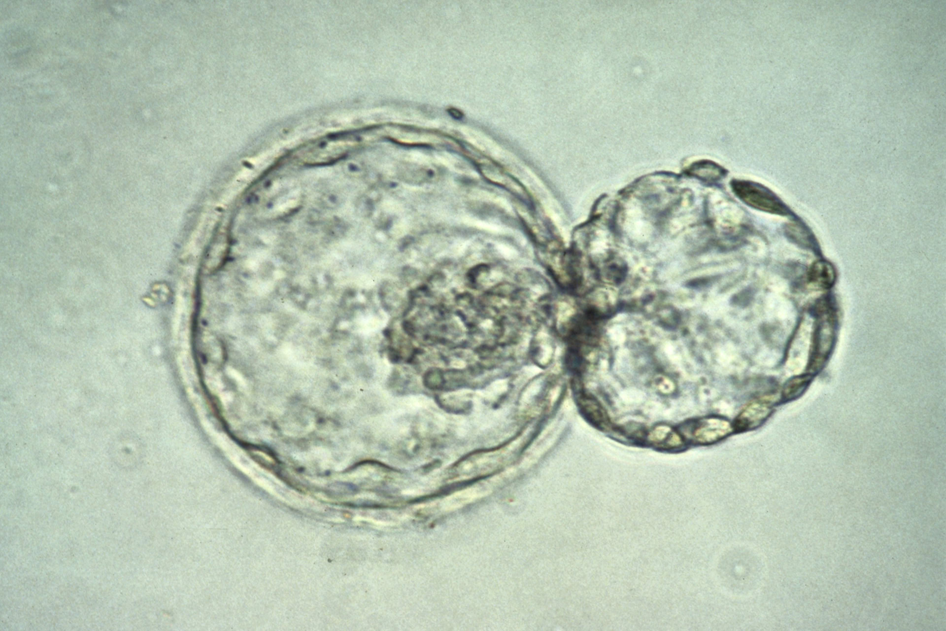 Image by K Hardy via the Wellcome Collection. Depicts a human embryo at the blastocyst stage (about six days after fertilisation) 'hatching' out of the zona pellucida.