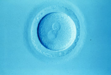 Image by Alan Handyside via the Wellcome Collection. Depicts a human egg soon after fertilisation, with the two parental pronuclei clearly visible.