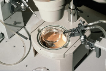Image by Alan Handyside via the Wellcome Collection. Depicts equipment used for embryo biopsy.